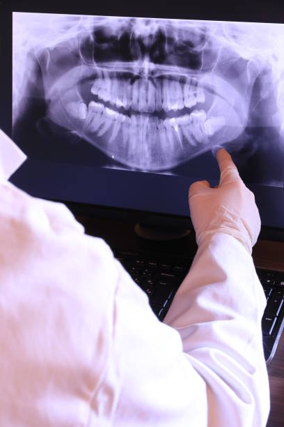 Best Emergency Dental Extractions in Granville, WV