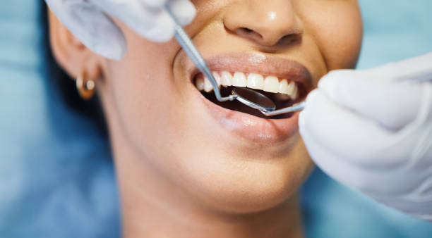 Best Broken or Cracked Tooth Emergency Dentist in Granville, WV