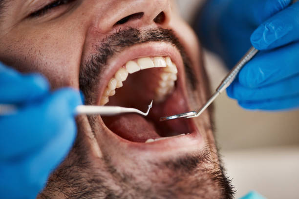 Best Orthodontic Emergency Dentist in Granville, WV