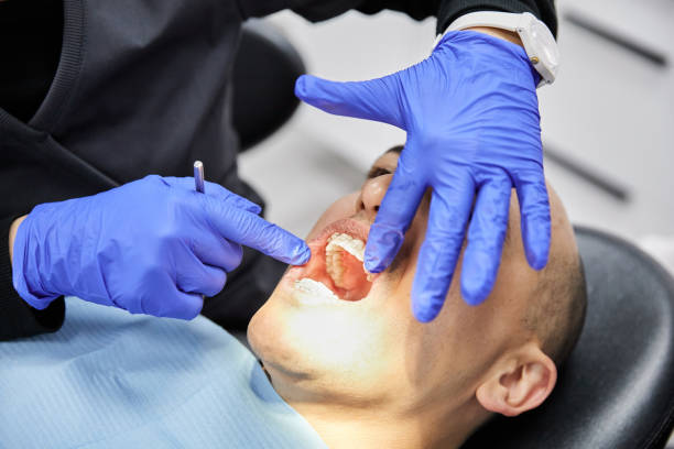 Best Emergency Dental Care for Abscessed Tooth in Granville, WV